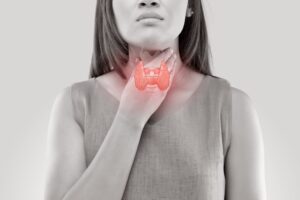 Thyroid Cancer