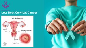 Cervical Cancer by Cancer Doctor