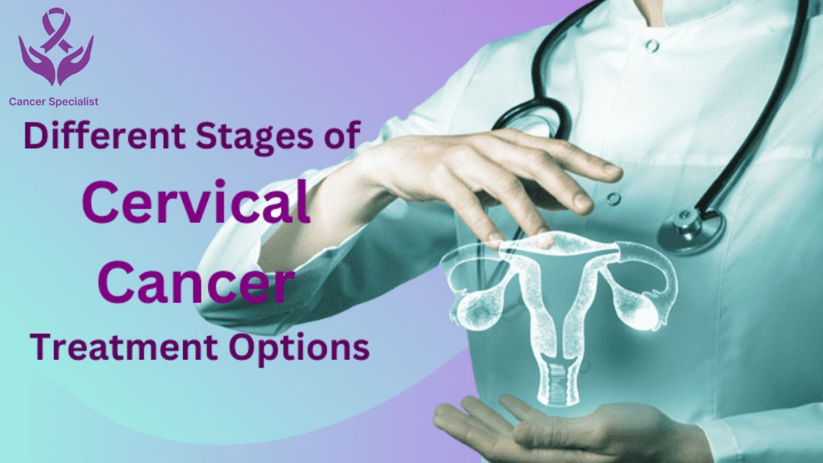 Cervical Cancer by Cancer Doctor