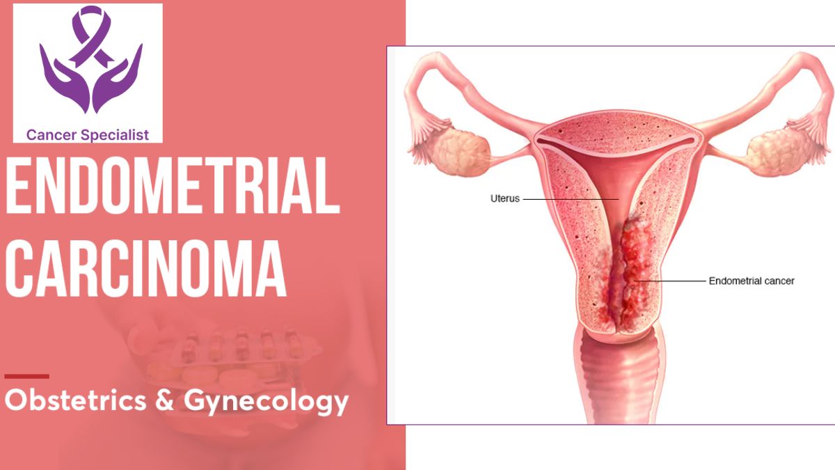 ENDOMETRIAL-CARCINOMA-Dr Suyash Agrawal- Best Cancer Specialist In Indore
