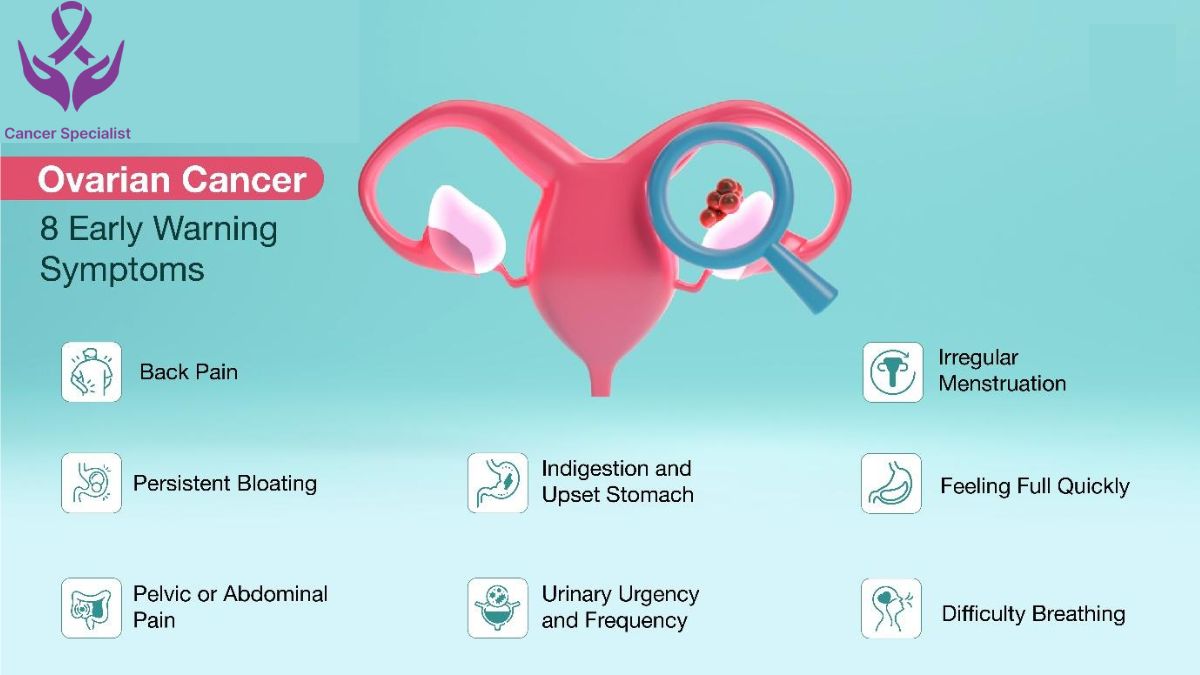 Ovarian Cancer Signs