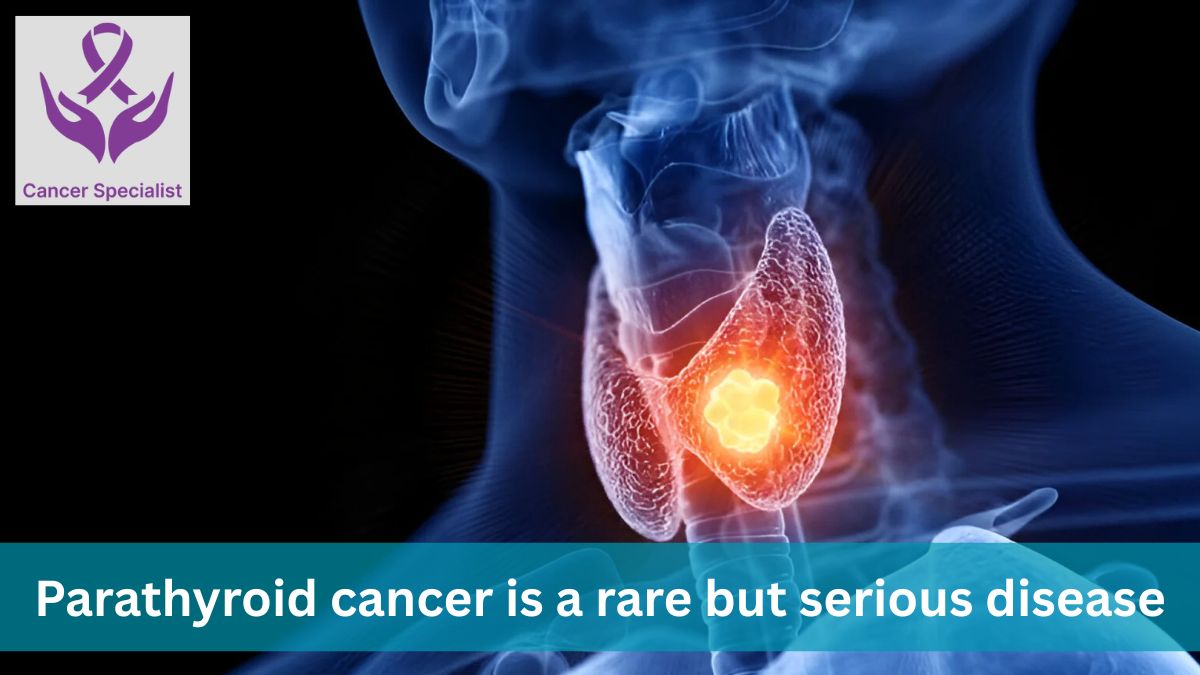 Parathyroid Cancer-Dr Suyash Agrawal-Cancer Specialist In Indore