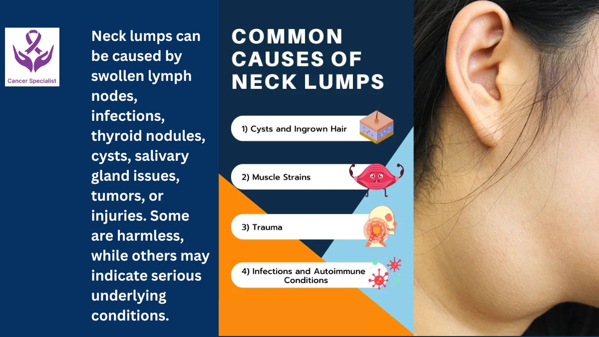 Neck Lump By Dr Suyash Agrawal - Best Oncologist Near Me