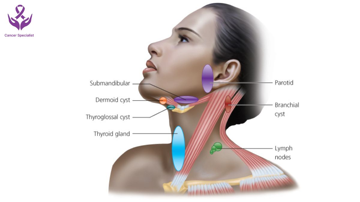 Neck Lump - Dr Suyash Agrawal -- Best Oncologist Near Me