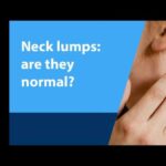 Neck Lump - Dr Suyash Agrawal - Best Oncologist Near Me