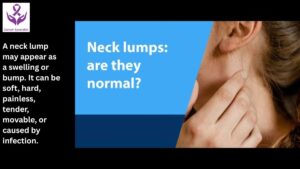 Neck Lump - Dr Suyash Agrawal - Best Oncologist Near Me