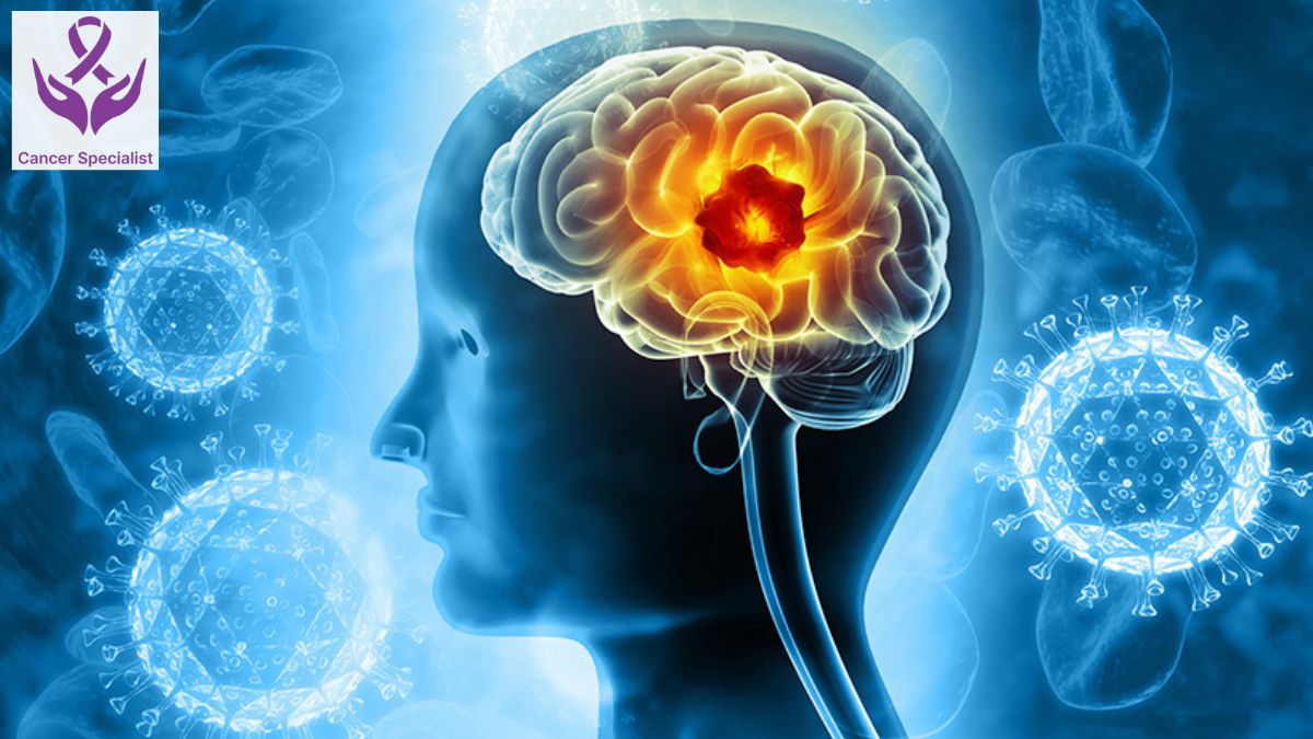 Brain Cancer Dr Suyash Agrawal Cancer Doctor Indore (3)