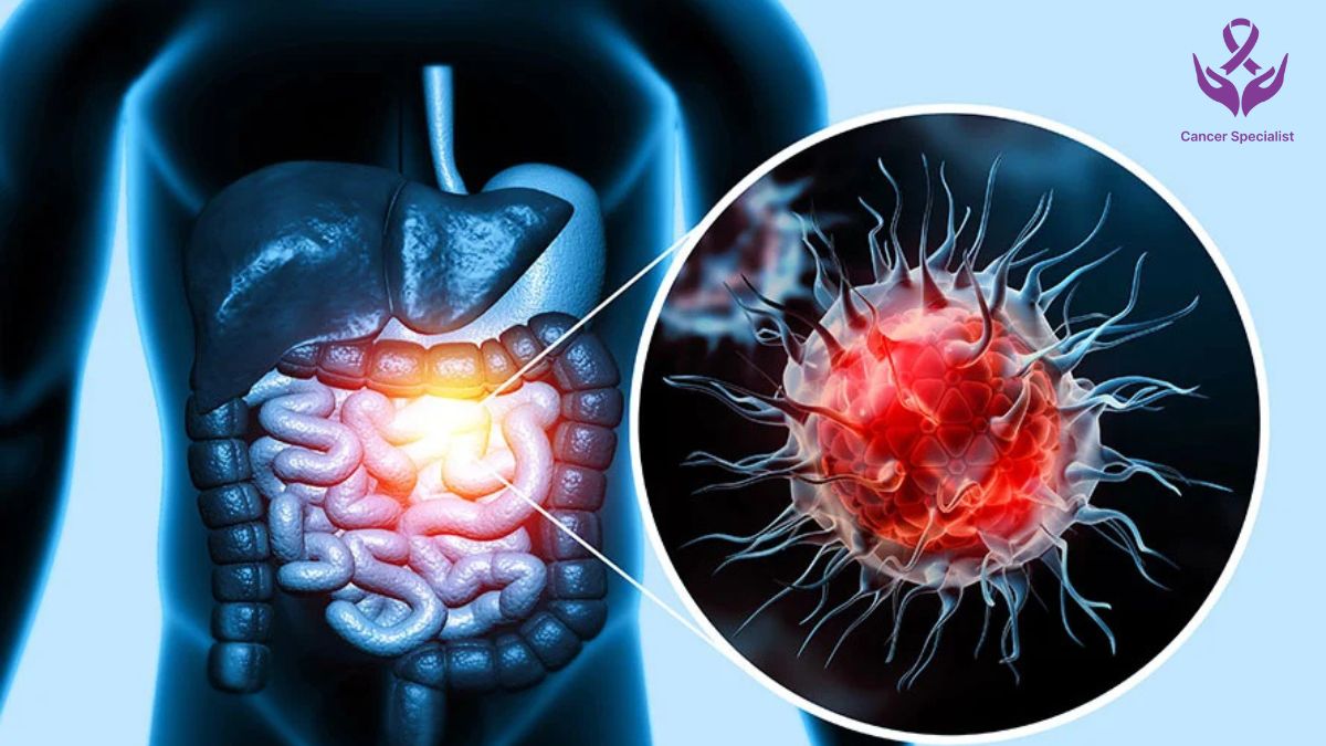 Know Everthing about Cancer by Dr Suyash Agrawal - A Cancer Doctor (1)