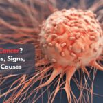 Know Everthing about Cancer by Dr Suyash Agrawal - A Cancer Doctor