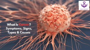 Know Everthing about Cancer by Dr Suyash Agrawal - A Cancer Doctor