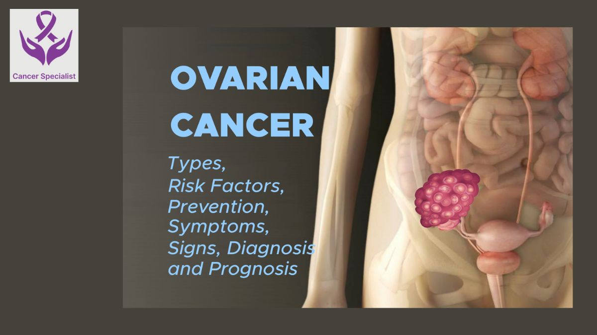 Ovarian Cancer Dr Suyash Agrawal Cancer Specialist (1)