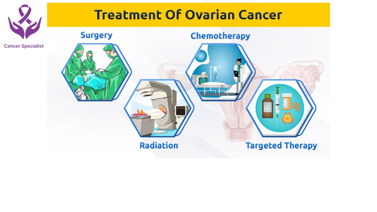 Ovarian Cancer Dr Suyash Agrawal Cancer Specialist (2)