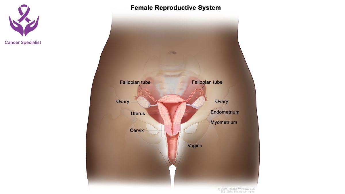 Ovarian Cancer Dr Suyash Agrawal Cancer Specialist (3)