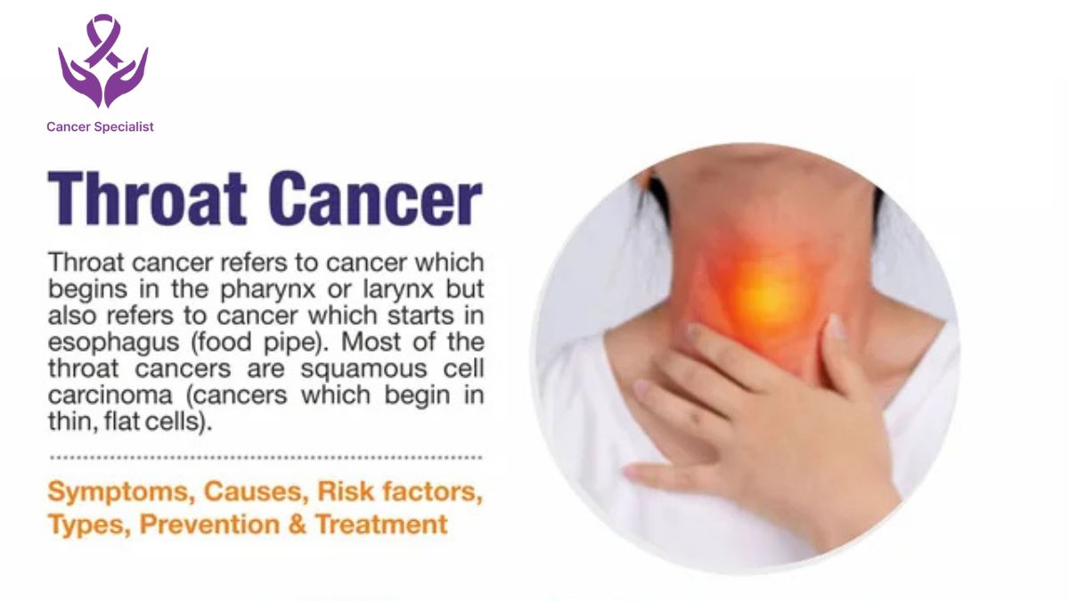 Throat Cancer by Dr Suyash Agrawal - Best Cancer Surgeon In Indore