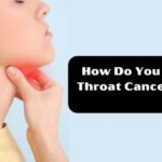 Throat cancer - Dr Suyash Agrawal - Best Cancer Surgeon In Indore