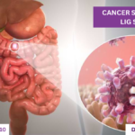 Best Cancer Specialist in LIG Square