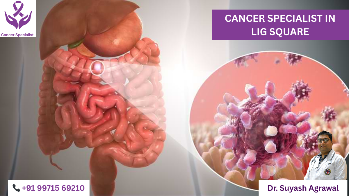 Best Cancer Specialist in LIG Square