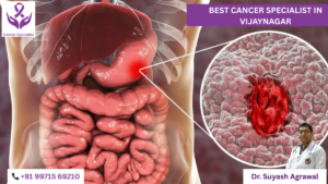 best cancer specialist in Vijayanagar Indore