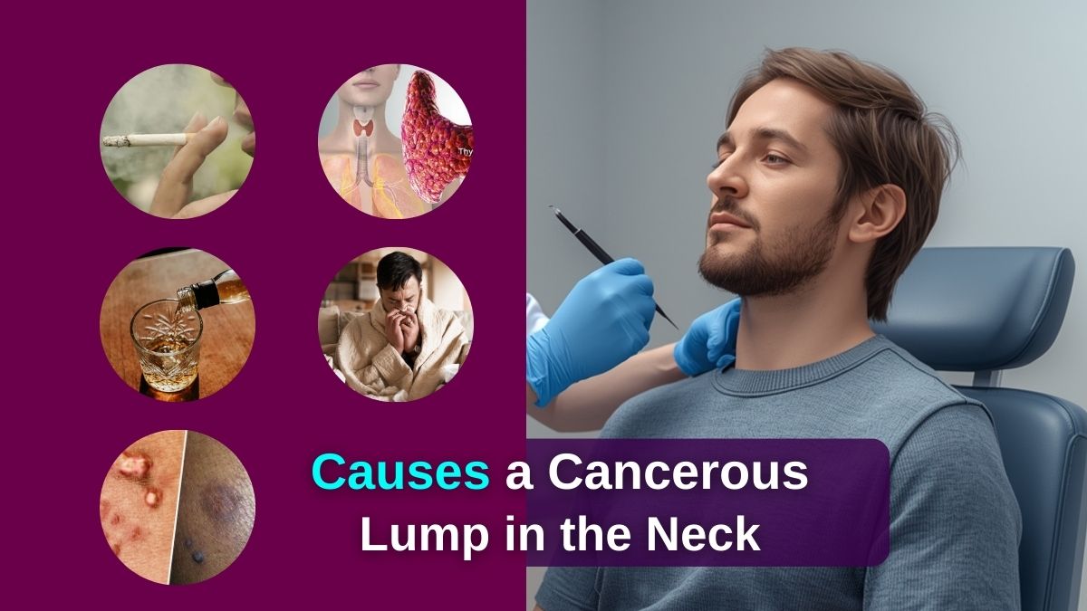 What Causes a Cancerous Lump in the Neck